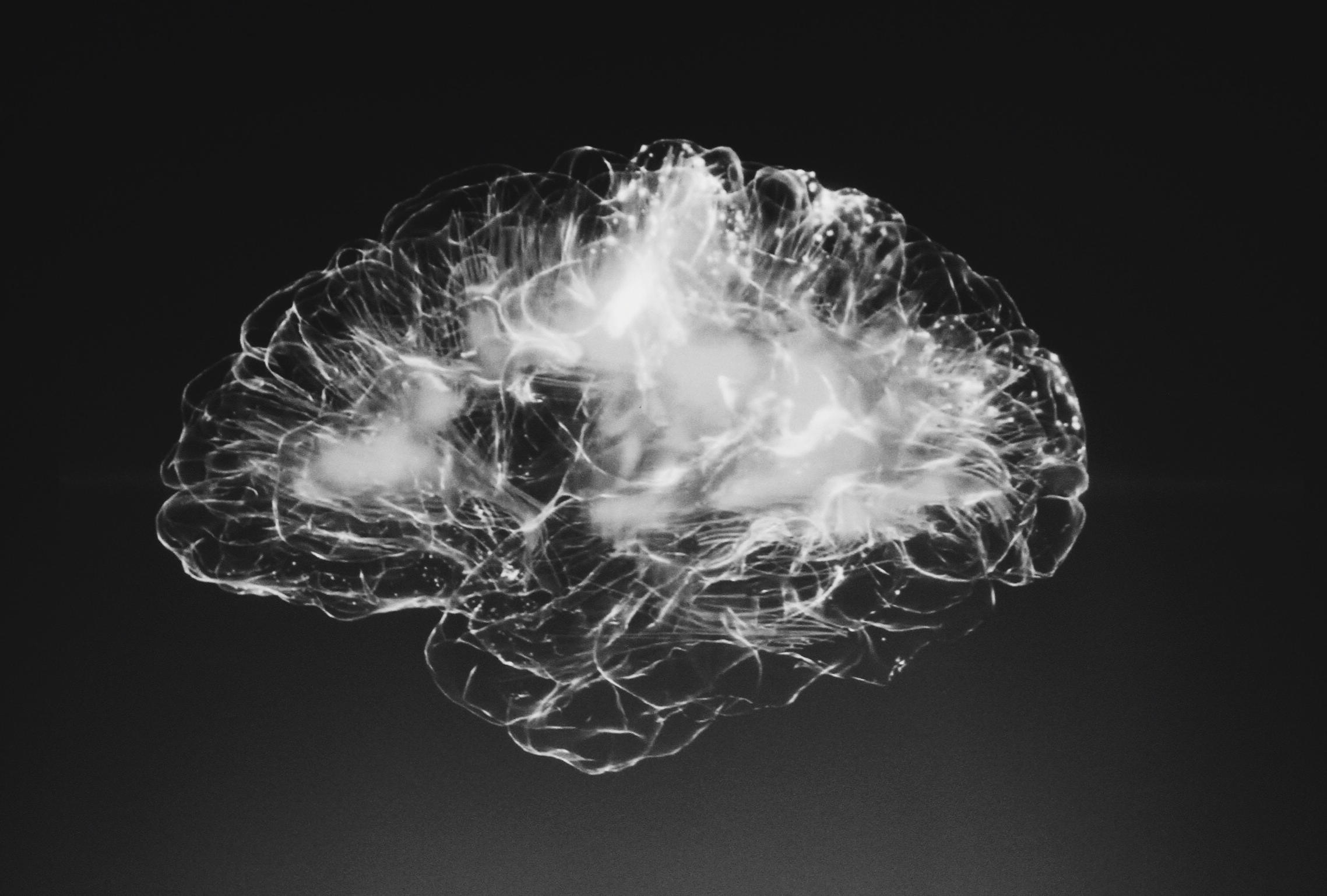 a scan of a brain feeling emotions 